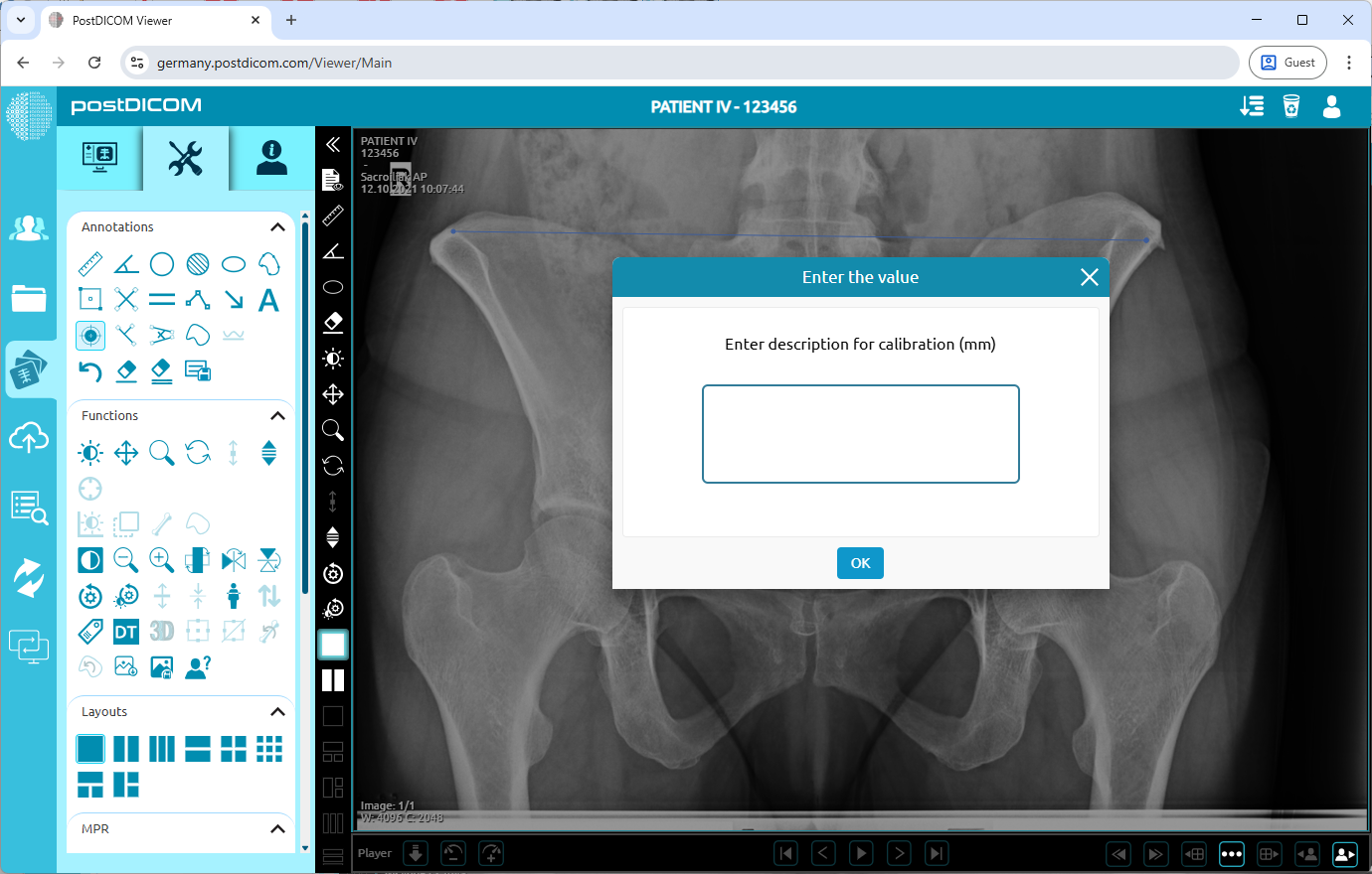 Using Calibration Tool